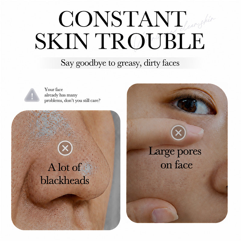 💥Hot Sale🍓Greenacare® 2026 Next-Gen Anti Pores & Acne Clay Mask Stick