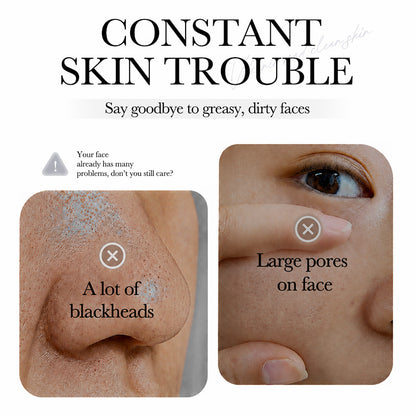 💥Hot Sale🍓Greenacare® 2026 Next-Gen Anti Pores & Acne Clay Mask Stick